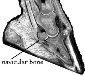 navicular bone